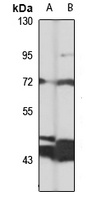 TBC1D23 Rabbit Polyclonal Antibody