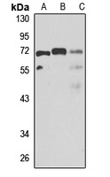 TBL1XR1 Rabbit Polyclonal Antibody