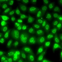 TBL1XR1 Rabbit Polyclonal Antibody