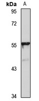 TBX20 Rabbit Polyclonal Antibody
