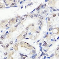 TBX20 Rabbit Polyclonal Antibody