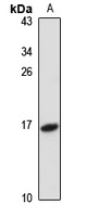 TCL-1B Rabbit Polyclonal Antibody