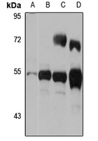 TDO2 Rabbit Polyclonal Antibody