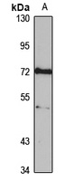 TDRD3 Rabbit Polyclonal Antibody