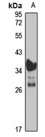 Transglutaminase 4 Rabbit Polyclonal Antibody