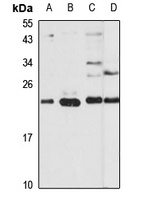 THOC7 Rabbit Polyclonal Antibody