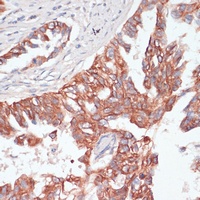TIAM1 Rabbit Polyclonal Antibody