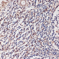 TLR5 Rabbit Polyclonal Antibody