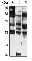 TMEFF2 Antibody