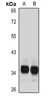 TMX1 Rabbit Polyclonal Antibody