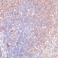 TMX1 Rabbit Polyclonal Antibody