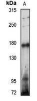 Tankyrase Rabbit Polyclonal Antibody