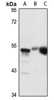 TOM1L1 Rabbit Polyclonal Antibody