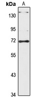 TOP1MT Rabbit Polyclonal Antibody