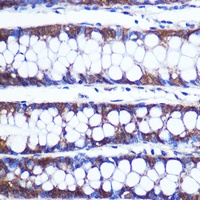 TOP1MT Rabbit Polyclonal Antibody