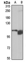 TRAPPC10 Rabbit Polyclonal Antibody