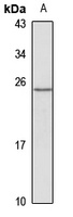 TREM2 Rabbit Polyclonal Antibody