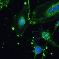 TREM2 Rabbit Polyclonal Antibody