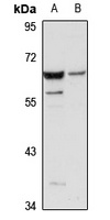 TRIM27 Rabbit Polyclonal Antibody