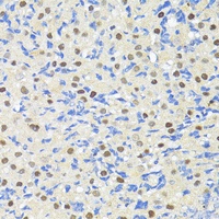 TRIM27 Rabbit Polyclonal Antibody