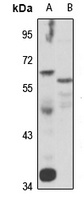 TRIM27 Rabbit Polyclonal Antibody