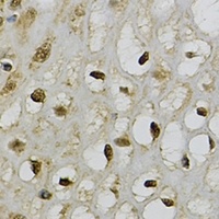 TRIM27 Rabbit Polyclonal Antibody