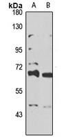 TRIM39 Rabbit Polyclonal Antibody