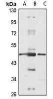 TRNT1 Rabbit Polyclonal Antibody
