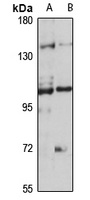 TRPC7 Rabbit Polyclonal Antibody