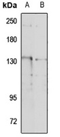 TRPM4 Rabbit Polyclonal Antibody