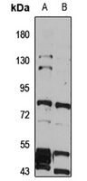 VRL-1 Rabbit Polyclonal Antibody