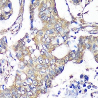 TXNDC9 Antibody