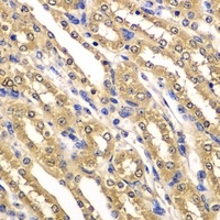 UBA3 Rabbit Polyclonal Antibody