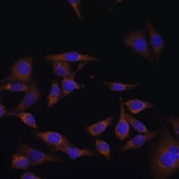 UBE2L6 Antibody