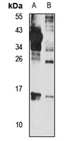 UBE2W Rabbit Polyclonal Antibody