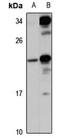 UFC1 Rabbit Polyclonal Antibody