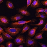 UFC1 Rabbit Polyclonal Antibody