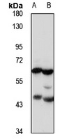 UGT1A4 Antibody