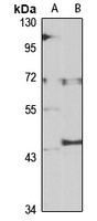 UGT1A4 Antibody