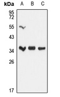 UPase 1 Rabbit Polyclonal Antibody