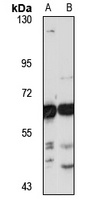 USP14 Rabbit Polyclonal Antibody