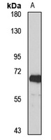 USP21 Rabbit Polyclonal Antibody