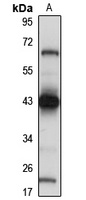 VMP1 Rabbit Polyclonal Antibody