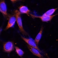 VMP1 Rabbit Polyclonal Antibody