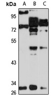 VNN2 Rabbit Polyclonal Antibody