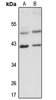 VPS26A Rabbit Polyclonal Antibody