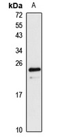 VPS29 Rabbit Polyclonal Antibody