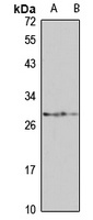WBP1 Rabbit Polyclonal Antibody