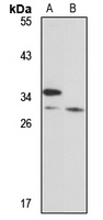 WBP2 Rabbit Polyclonal Antibody
