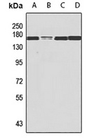 NSD3 Rabbit Polyclonal Antibody